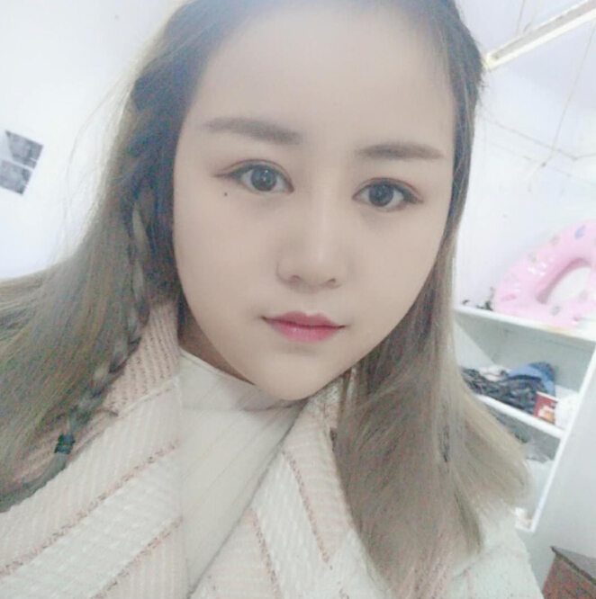 鄭州美麗時光整形醫(yī)生馬戰(zhàn)勝做雙眼皮+隆胸案例效果對比圖