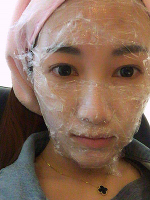 重慶五洲女子醫(yī)院整形美容中心做光子嫩膚怎么樣？淡明斌醫(yī)生光子嫩膚案例