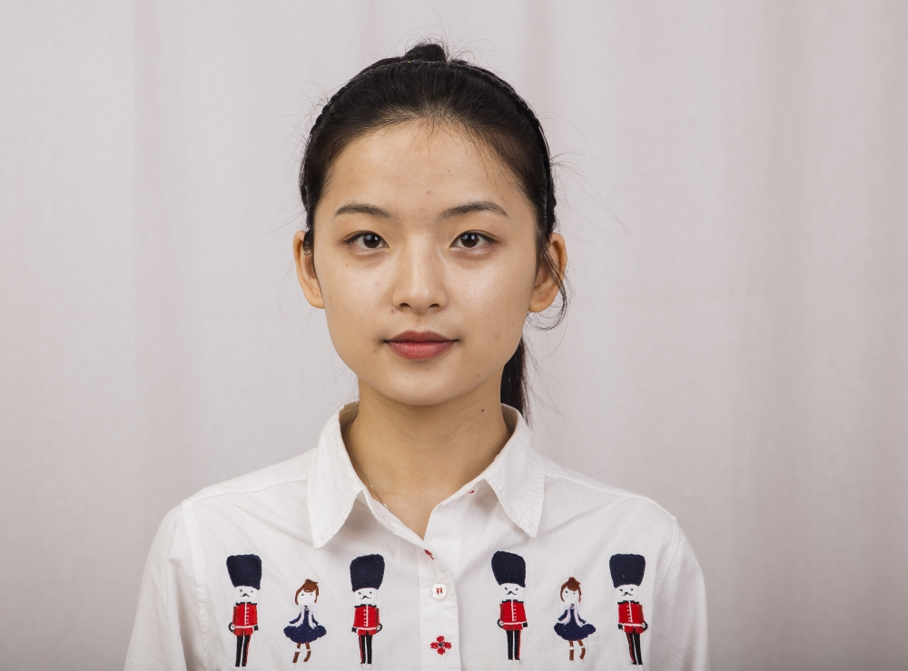 鄭州名門整形醫(yī)院董斌醫(yī)生做下頜角整形怎么樣？附下頜角整形案例