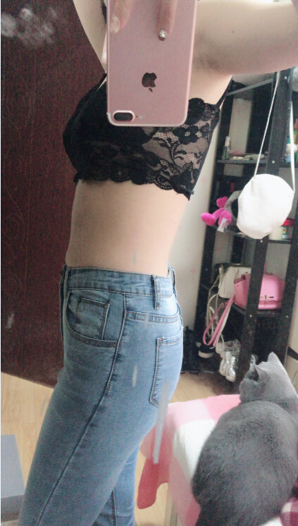 長沙亞韓醫(yī)學整形醫(yī)生米勒做腰腹吸脂效果怎么樣？米勒腰腹吸脂案例