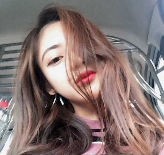 珠海平安康復醫(yī)院整形美容中心查元坤醫(yī)生面部吸脂案例效果對比圖