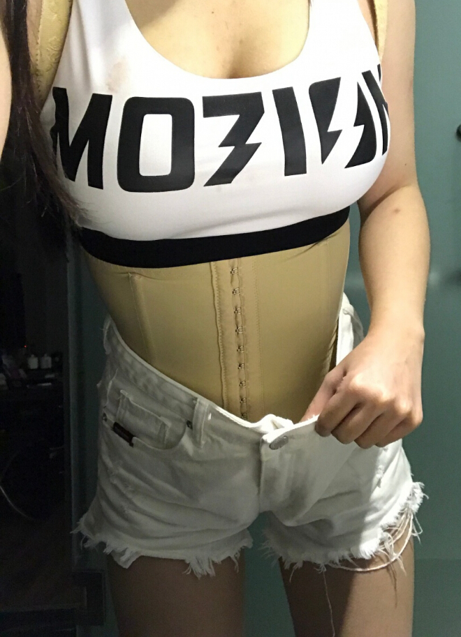 長沙亞韓醫(yī)學整形醫(yī)生米勒做腰腹吸脂效果怎么樣？米勒腰腹吸脂案例