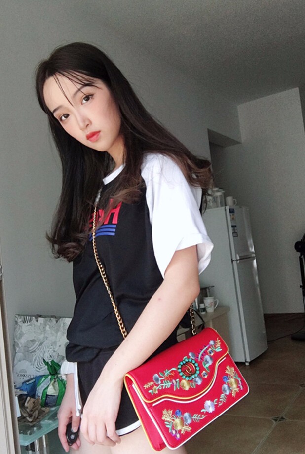 重慶威妮醫(yī)療整形醫(yī)生伊莉做切開雙眼皮+開眼角真人案例效果對(duì)比圖 重慶威妮醫(yī)療整形醫(yī)生伊莉做切開雙眼皮+開眼角真人案例效果對(duì)比圖