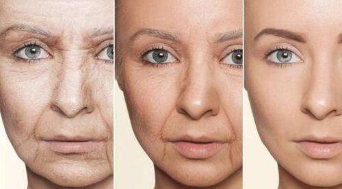 貴陽(yáng)美和諧整形自體脂肪填充