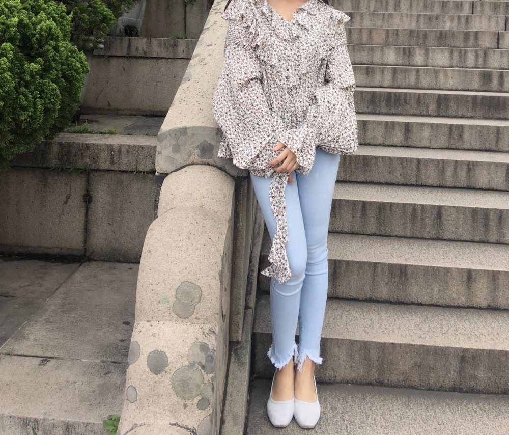 晉城鳳凰整形美容醫(yī)院宋發(fā)興醫(yī)生做大腿吸脂怎么樣？附大腿吸脂案例