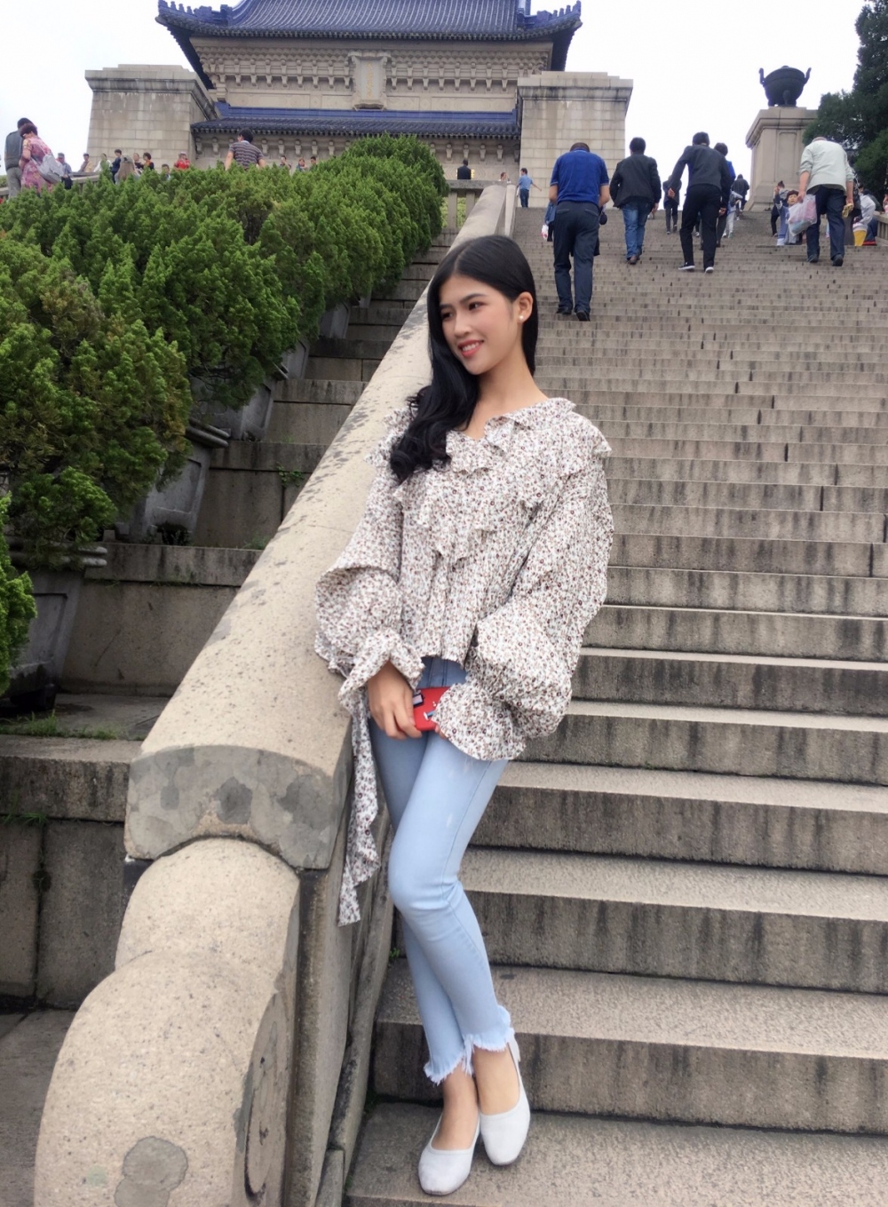 晉城鳳凰整形美容醫(yī)院宋發(fā)興醫(yī)生做大腿吸脂怎么樣？附大腿吸脂案例