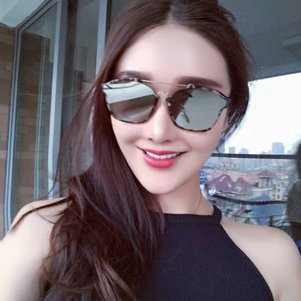 廣州柏德口腔蘭海龍醫(yī)生做瓷貼面效果怎么樣？廣州柏德口腔瓷貼面案例分享