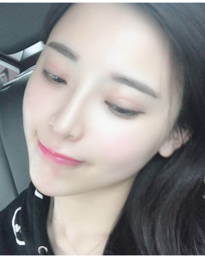 襄陽(yáng)維多利亞整形醫(yī)院安邰晥醫(yī)生做鼻綜合整形怎么樣？附鼻綜合整形案例