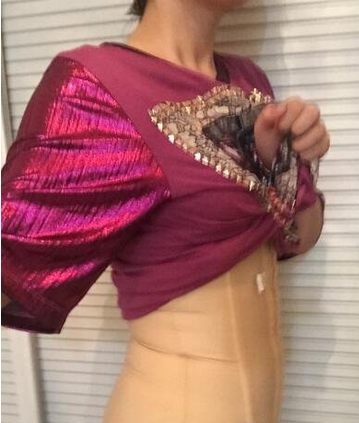 成都蜀尚蓉雅整形醫(yī)生張知華做腰腹吸脂效果怎么樣？附腰腹吸脂案例