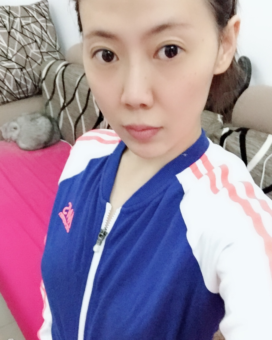 煙臺壹美整形醫(yī)院朱建瑩醫(yī)生做自體脂肪隆胸怎么樣？附自體脂肪隆胸案例