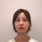 天津歐華威莎整形醫(yī)生姚玲做面部埋線提升效果怎么樣？附埋線提升案例