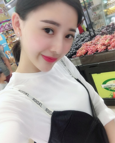 襄陽維多利亞整形醫(yī)院安邰晥醫(yī)生做鼻綜合整形怎么樣？附鼻綜合整形案例