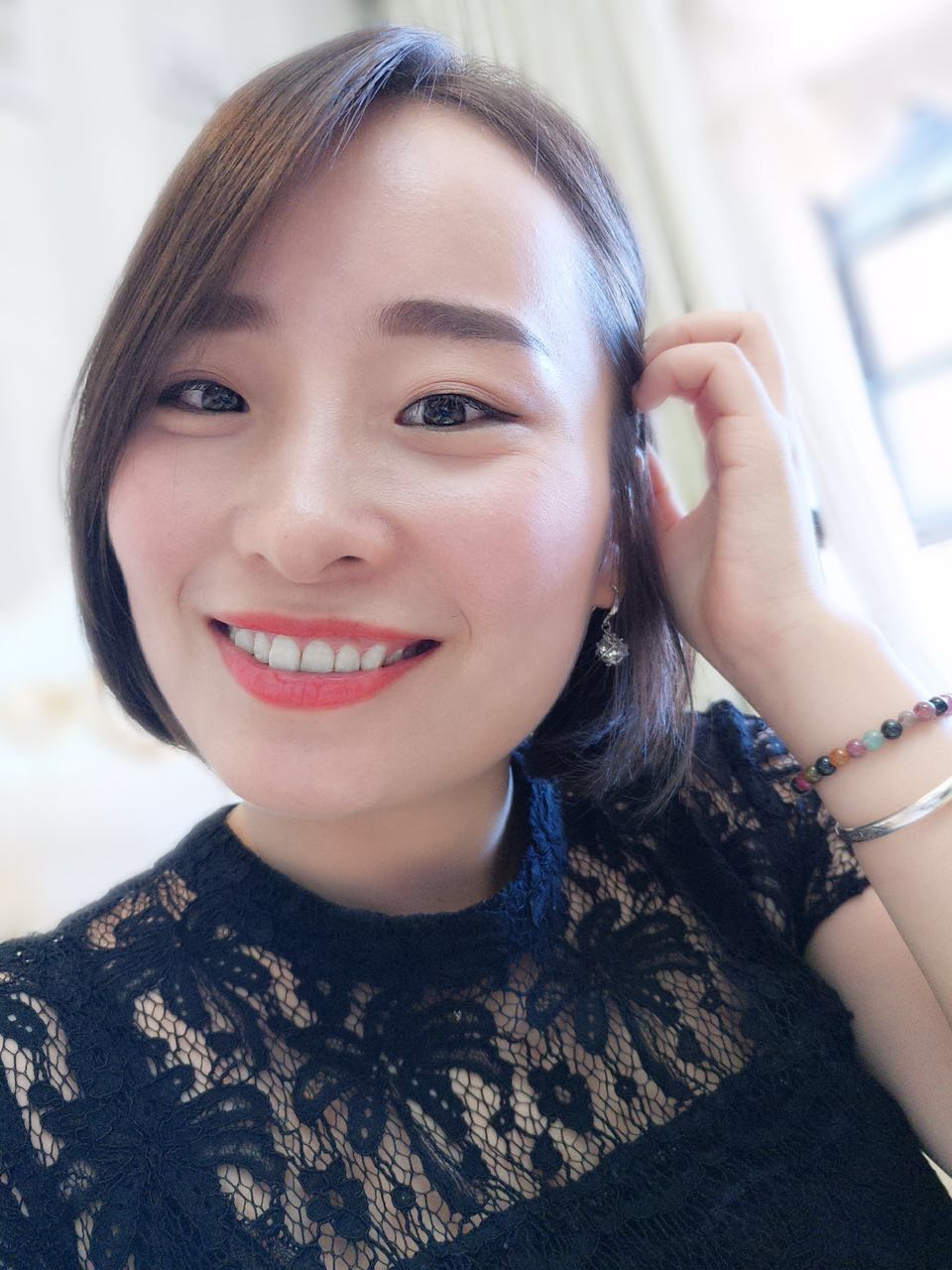 鄭州壹加壹整形醫(yī)院楊永利醫(yī)生做牙齒隱形矯正怎么樣？附牙齒隱形矯正案例