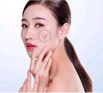 ?？诩t妝尚整形光子嫩膚