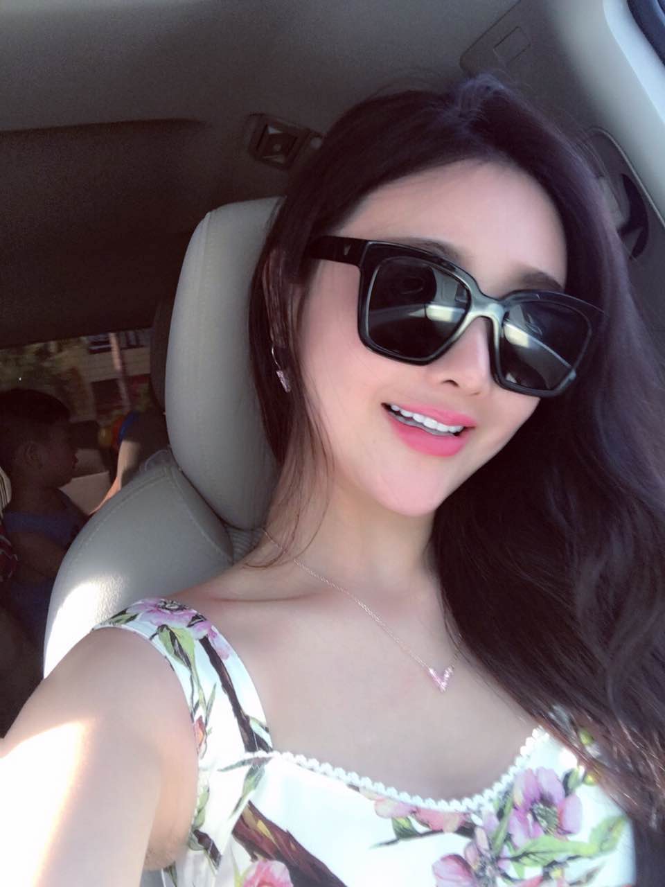 廣州柏德口腔蘭海龍醫(yī)生做瓷貼面效果怎么樣？廣州柏德口腔瓷貼面案例分享