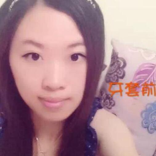 重慶嘉悅口腔醫(yī)院周繼祥醫(yī)生做金屬托槽矯正效果怎么樣？附案例效果對比圖