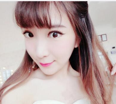 武漢中翰整形外科醫(yī)院陳志鵬醫(yī)生做雙眼皮修復(fù)效果怎么樣？附雙眼皮修復(fù)案例