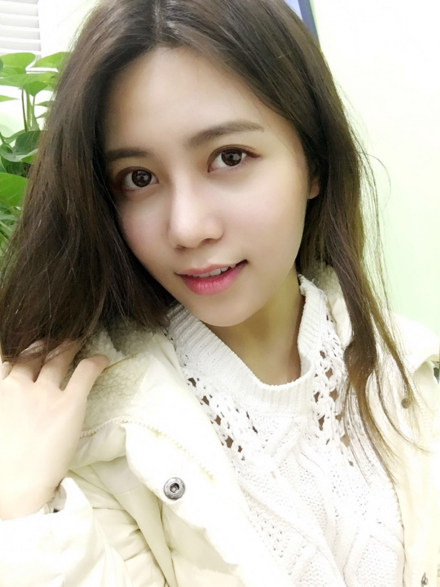 重慶美圣美邦整形醫(yī)院劉力維醫(yī)生做自體脂肪全臉填充案例效果對(duì)比圖