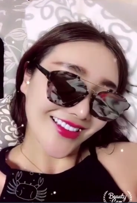 廣州柏德口腔蘭海龍醫(yī)生做瓷貼面效果怎么樣？廣州柏德口腔瓷貼面案例分享