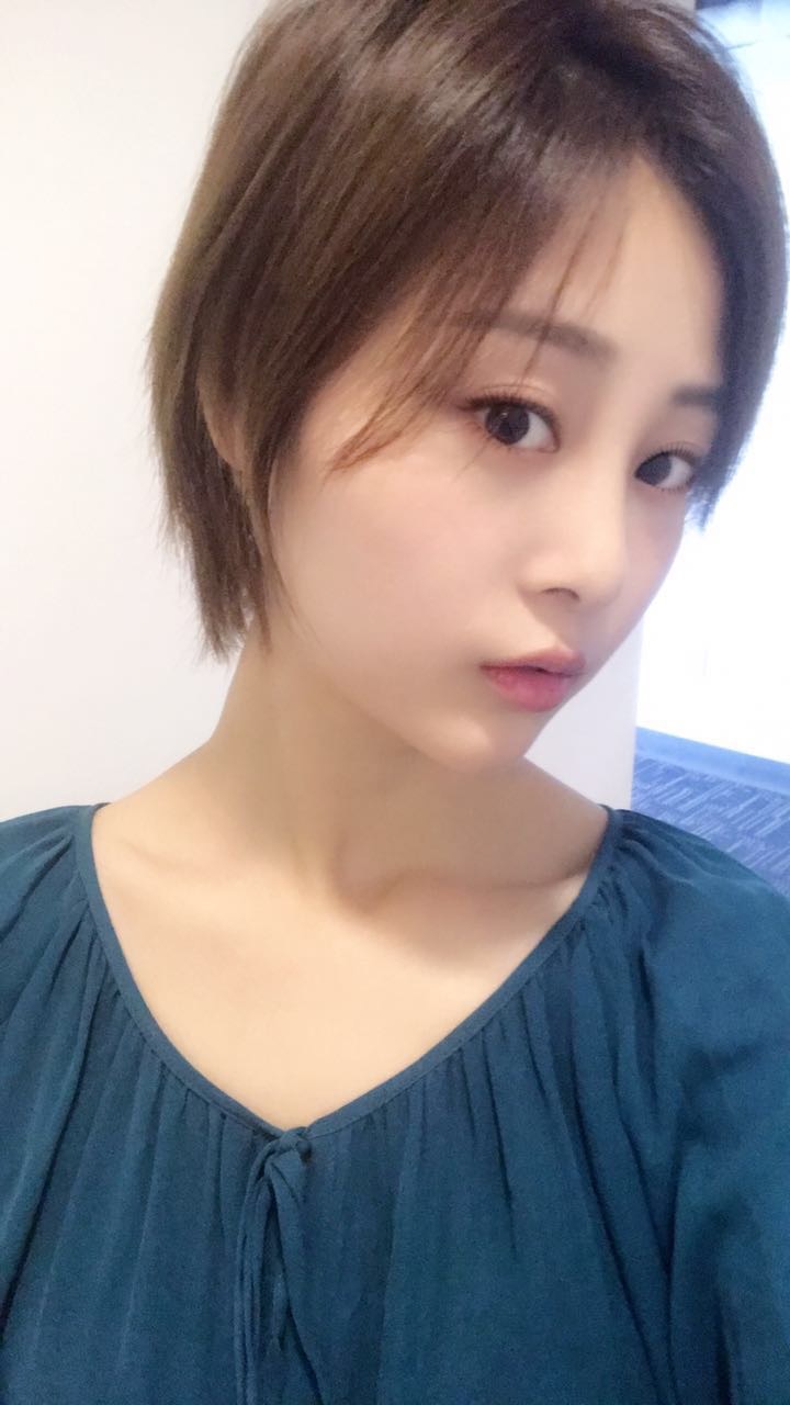 天津歐華威莎整形醫(yī)生姚玲做面部埋線提升效果怎么樣？附埋線提升案例