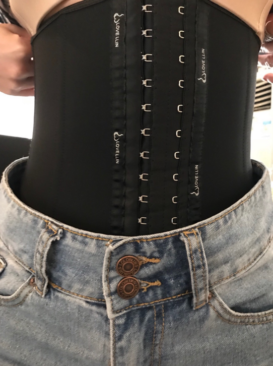 沈陽(yáng)天使醫(yī)療整形醫(yī)生黃展翼做水動(dòng)力腰腹吸脂技術(shù)怎么樣？附水動(dòng)力腰腹吸脂案例