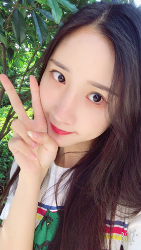 湛江澳泰整形醫(yī)院彭鑫醫(yī)生做自體脂肪豐蘋(píng)果肌+太陽(yáng)穴案例效果對(duì)比圖