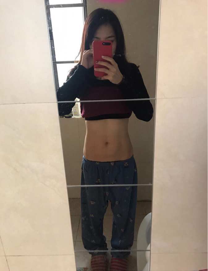 沈陽(yáng)天使醫(yī)療整形醫(yī)生黃展翼做水動(dòng)力腰腹吸脂技術(shù)怎么樣？附水動(dòng)力腰腹吸脂案例