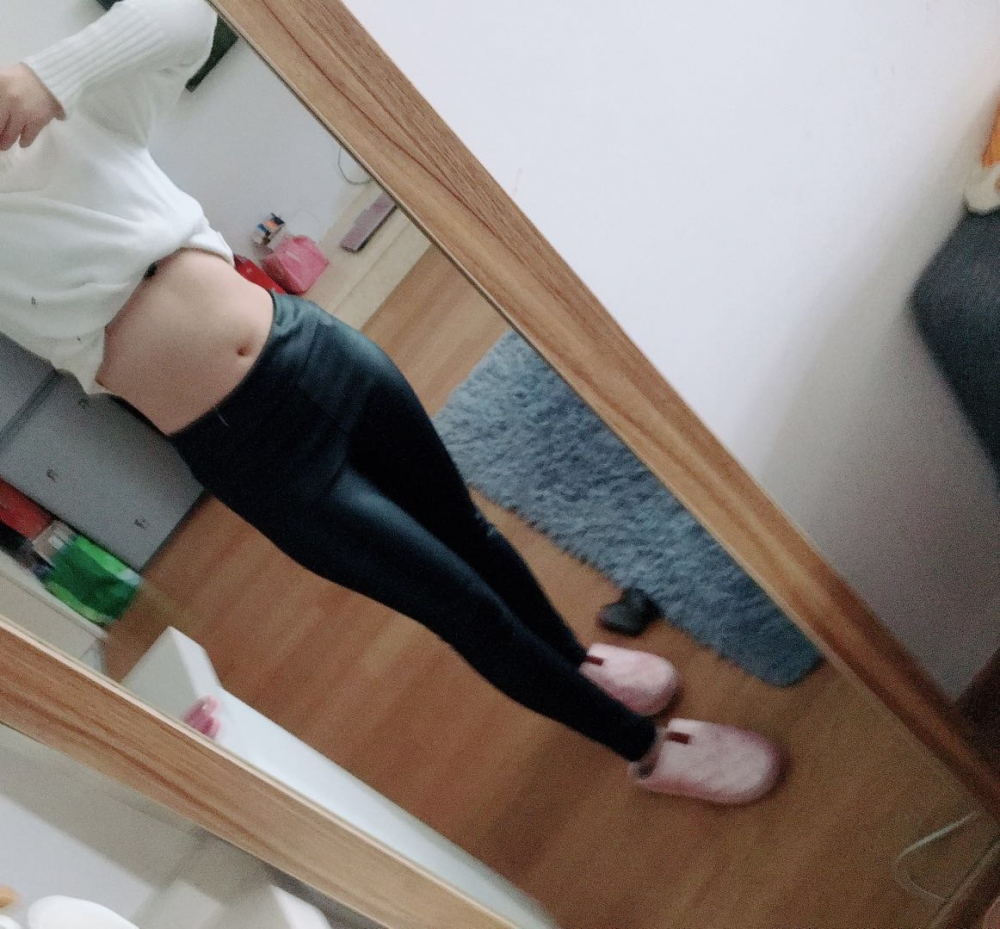 肇慶華美整形醫(yī)院陳巍醫(yī)生做腰腹吸脂效果怎么樣？附腰腹吸脂案例