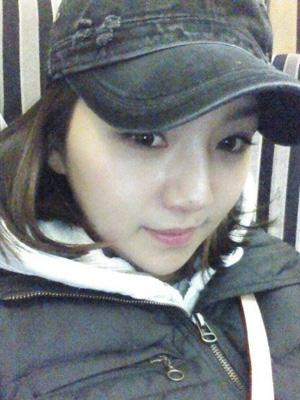 長春中妍整形醫(yī)院吳學(xué)軍醫(yī)生做玻尿酸墊下巴+玻尿酸豐太陽穴案例效果對比圖