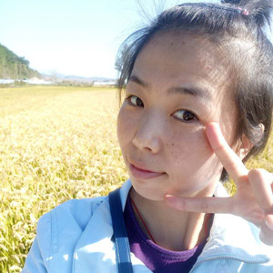 珠海蒂伊醫(yī)療整形醫(yī)生廖俊凱做激光祛斑效果怎么樣？附激光祛斑案例效果圖