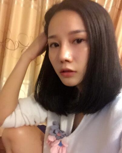 西安陽光整形醫(yī)院邵萍醫(yī)生做鼻綜合整形怎么樣？附鼻綜合整形案例