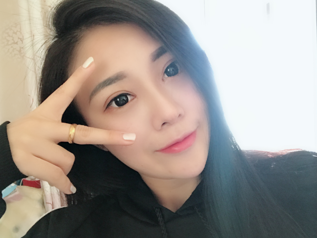 石家莊雅芳亞整形醫(yī)生王文明做雙眼皮+開眼角+鼻綜合整形案例效果對比圖 石家莊雅芳亞整形醫(yī)生王文明做雙眼皮+開眼角+鼻綜合整形案例效果對比圖