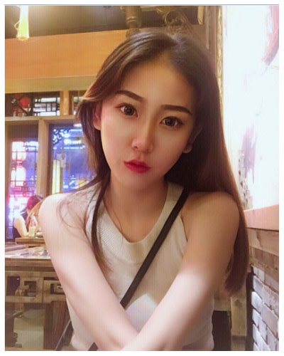 珠海海大整形美容外科黃發(fā)醫(yī)生做面部吸脂怎么樣？附面部吸脂案例