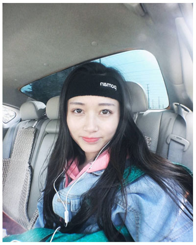 義烏傅氏口腔醫(yī)生朱雨晴做牙齒隱形矯正效果怎么樣？附牙齒隱形矯正案例