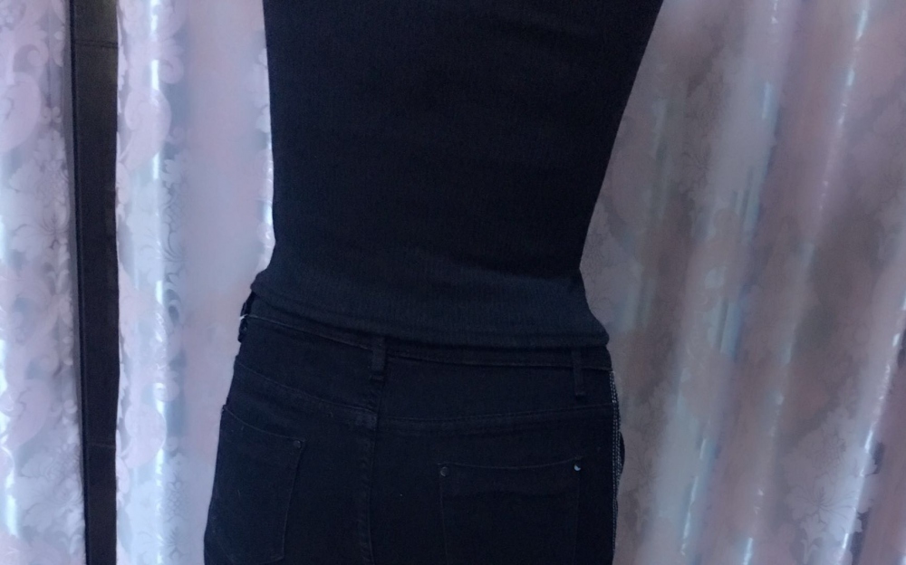 肇慶華美整形醫(yī)院陳巍醫(yī)生做腰腹吸脂效果怎么樣？附腰腹吸脂案例