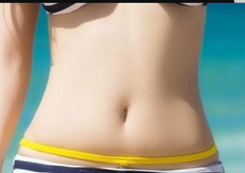 濟南海峽美容整形醫(yī)院腰腹吸脂
