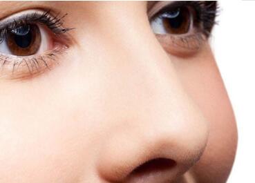 馬鞍山美芙醫(yī)療鼻翼縮小