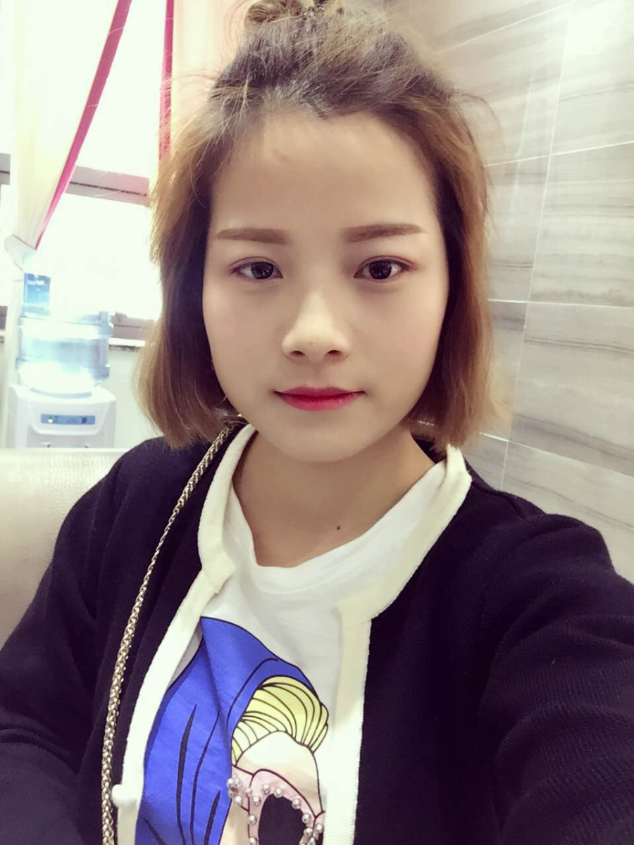 西安藝星醫(yī)療整形醫(yī)院李國玲做鼻綜合整形怎么樣？附李國玲鼻綜合整形案例