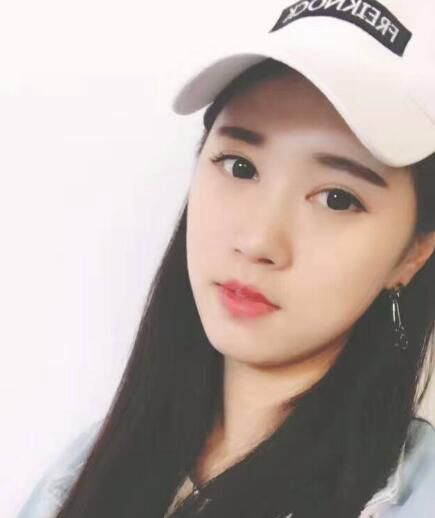 北京亞奧整形醫(yī)生程金龍做韓式三點雙眼皮+開內(nèi)眼角效果怎么樣？