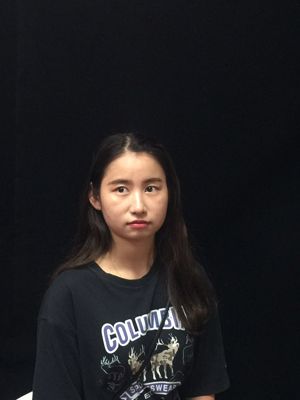 西安高一生整形醫(yī)院何志洪做埋線提升效果怎么樣？附埋線提升案例