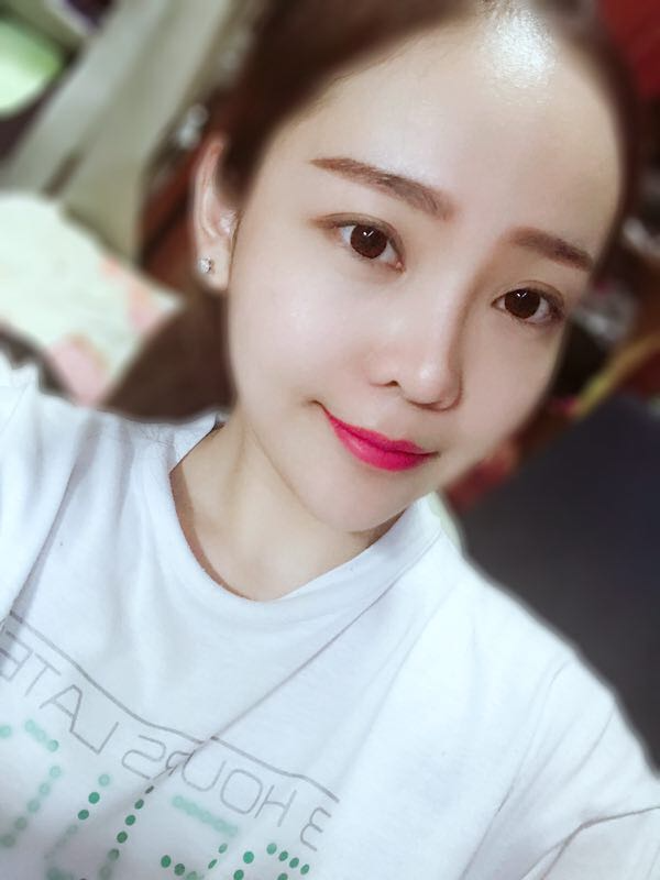 北京可思美醫(yī)療整形醫(yī)生蘇靜做臉部自體脂肪填充效果怎么樣？