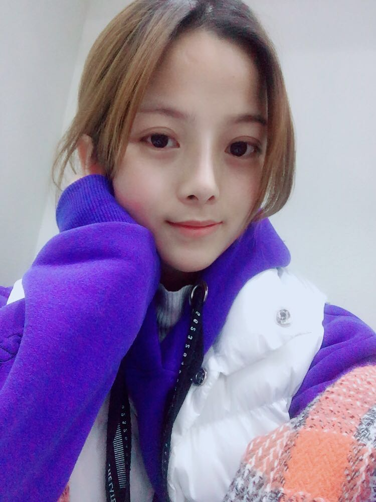 西安藝星醫(yī)療整形醫(yī)院李國玲做鼻綜合整形怎么樣？附李國玲鼻綜合整形案例