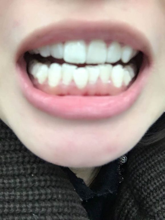 1518504250936378.jpg 1518504250936378.jpg