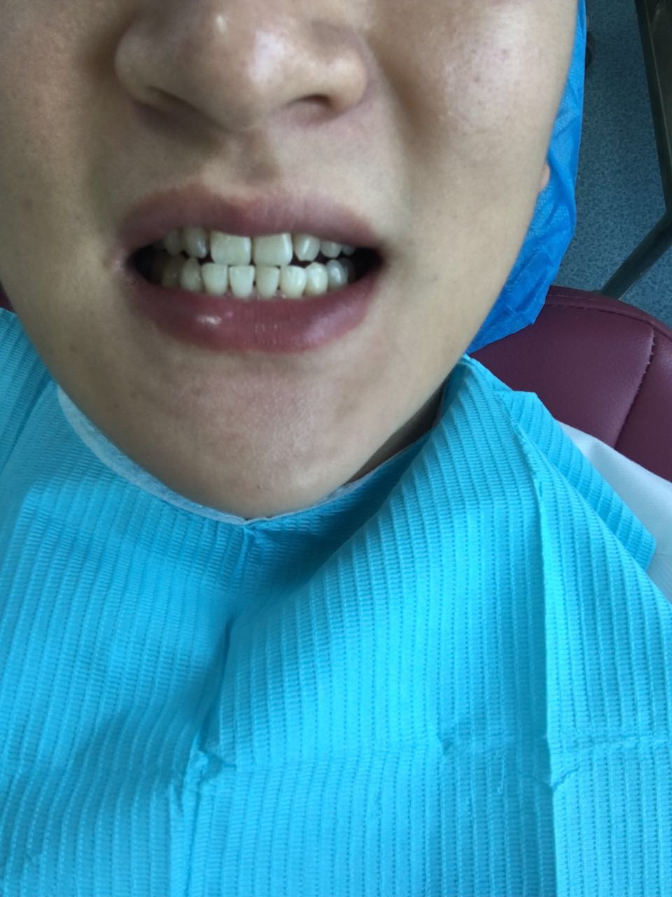 1518413693131157.jpg 1518413693131157.jpg