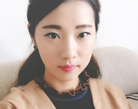 北京亞奧整形醫(yī)生程金龍做韓式三點雙眼皮+開內(nèi)眼角效果怎么樣？