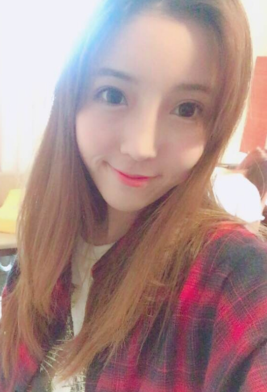 鄭州致美士整形醫(yī)院醫(yī)生閆江濤做鼻綜合+自體脂肪填充+吸脂案例效果對比圖