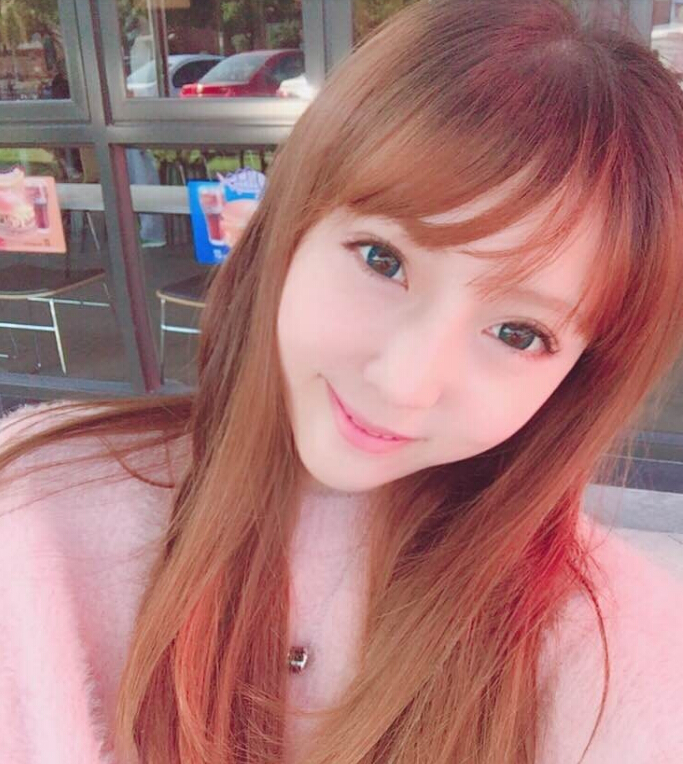 鄭州致美士整形醫(yī)院醫(yī)生閆江濤做鼻綜合+自體脂肪填充+吸脂案例效果對(duì)比圖