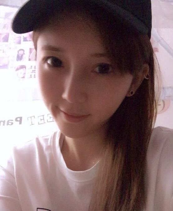 鄭州致美士整形醫(yī)院醫(yī)生閆江濤做鼻綜合+自體脂肪填充+吸脂案例效果對比圖