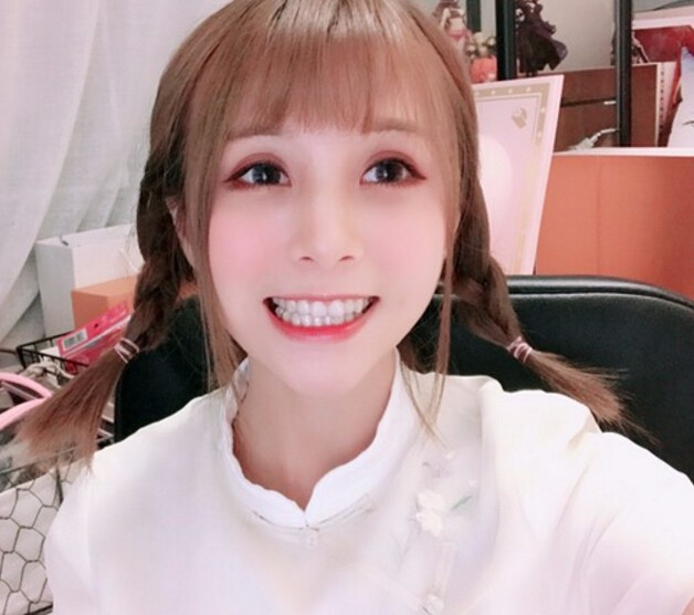 廣州德倫口腔醫(yī)生程武做隱形托槽矯正怎么樣？附隱形托槽矯正案例效果對(duì)比圖