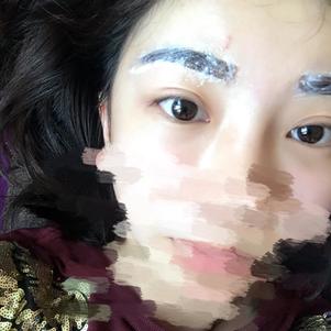 大同清木整形醫(yī)院張樹(shù)霞醫(yī)生做半永久紋眉效果如何？附半永久紋眉效果圖